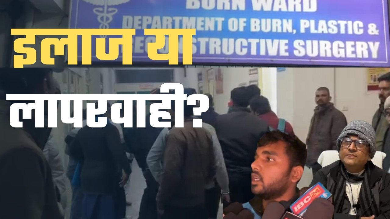 रीवा SGH में बर्न यूनिट पर सवाल, फाइल में गलत नाम–ब्लड ग्रुप तक नहीं बताया
